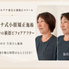 小顔矯正効果ビフォアアフター